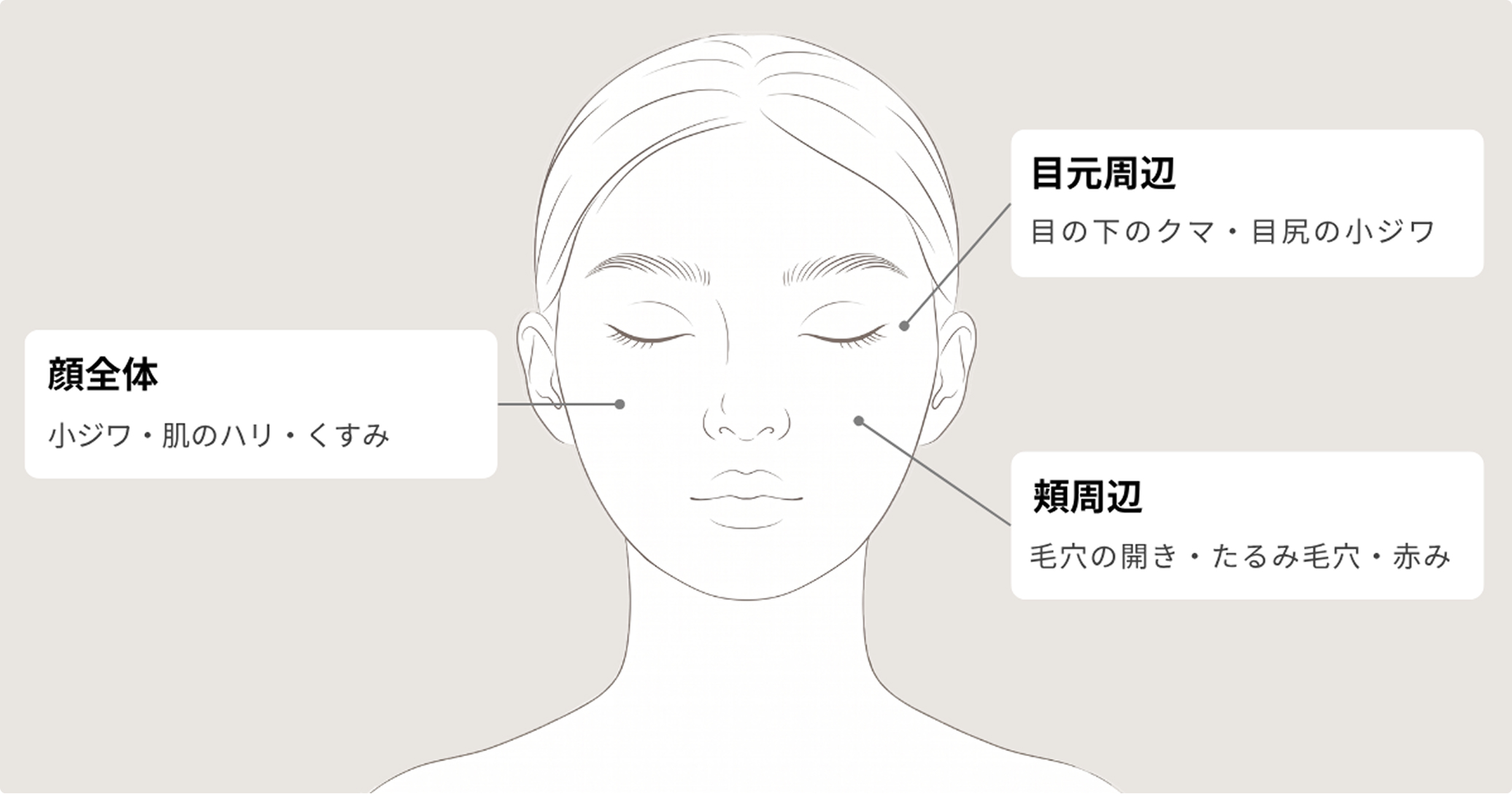 プルリアル デンシファイで改善が期待できる部位のマップ